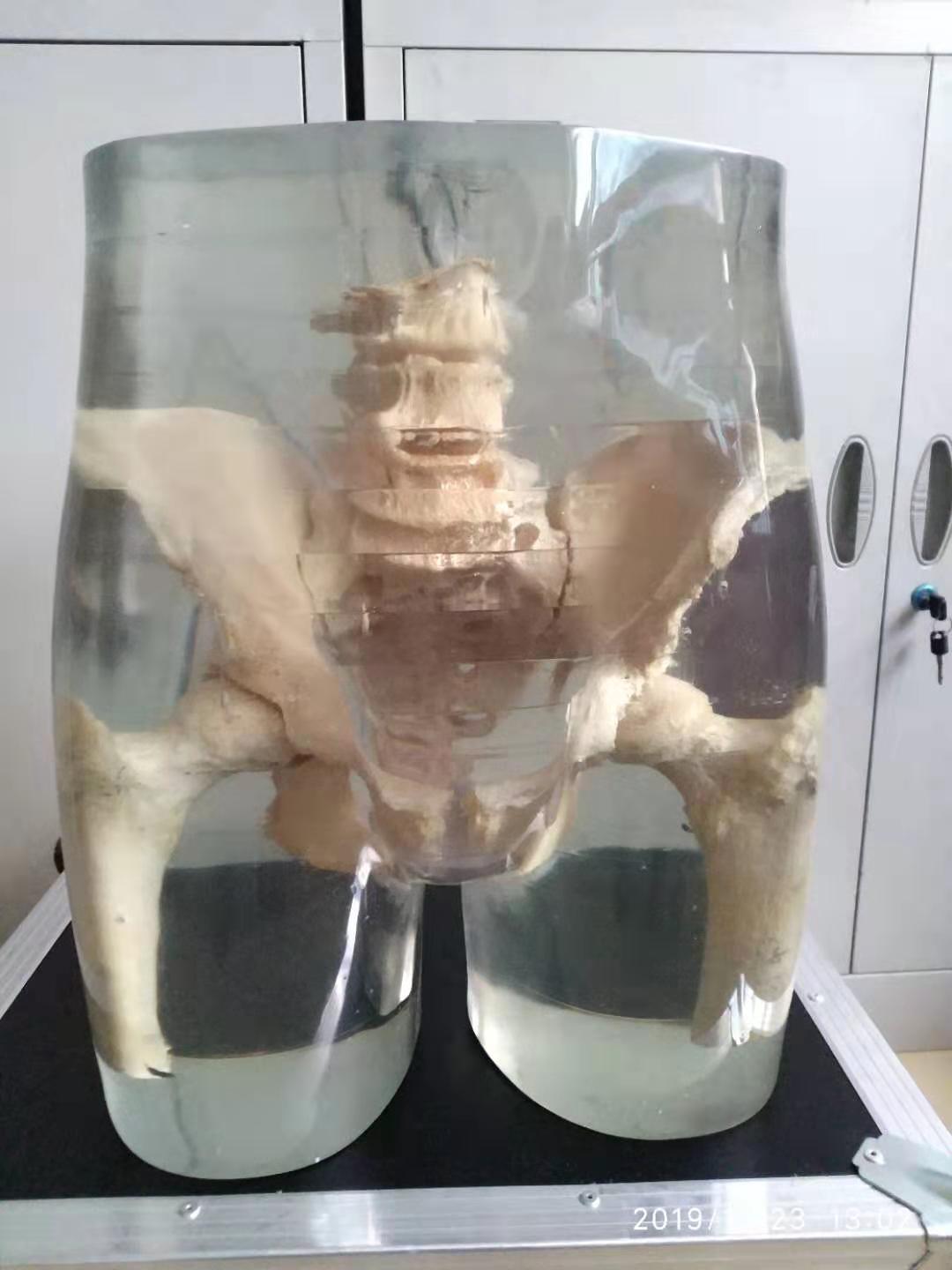 ˹ͷXֲģ壬X߽Ųģ壬XŹؽģ